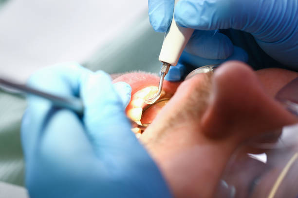 Best Emergency Care for Gum Disease in Vashon, WA