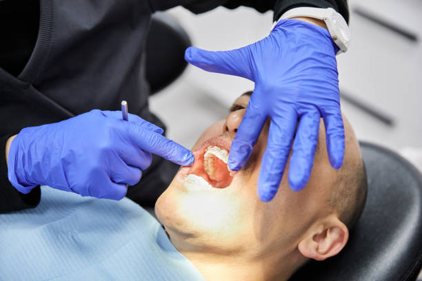 Best Emergency Dental Care for Sports Injuries in Vashon, WA